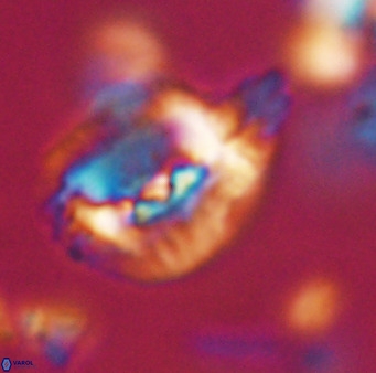 Helicosphaerella bipuncta VR 32968