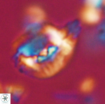 Helicosphaerella bipuncta VR 32968