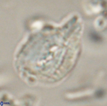Helicosphaerella bipuncta VR 32969