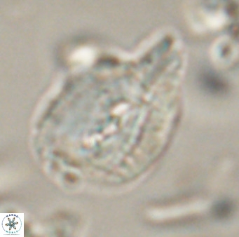 Helicosphaerella bipuncta VR 32969