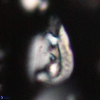 Helicosphaerella bipuncta VR 32963