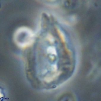 Helicosphaerella bipuncta VR 32974