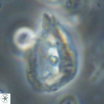 Helicosphaerella bipuncta VR 32974