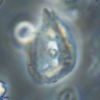 Helicosphaerella bipuncta VR 32975
