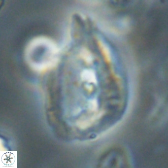 Helicosphaerella bipuncta VR 32975