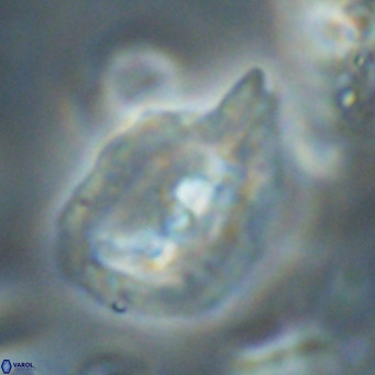 Helicosphaerella bipuncta VR 32976