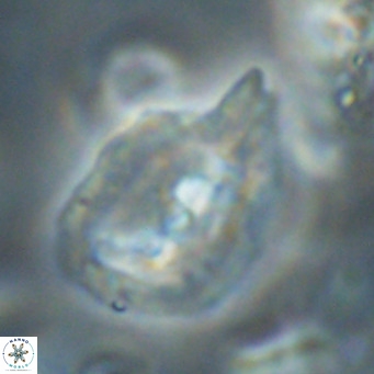 Helicosphaerella bipuncta VR 32976