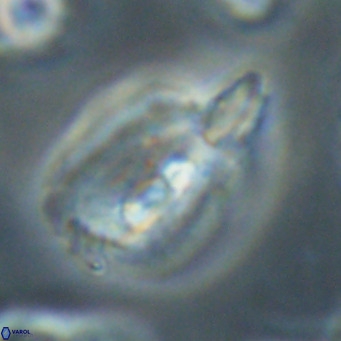 Helicosphaerella bipuncta VR 32977