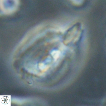 Helicosphaerella bipuncta VR 32977