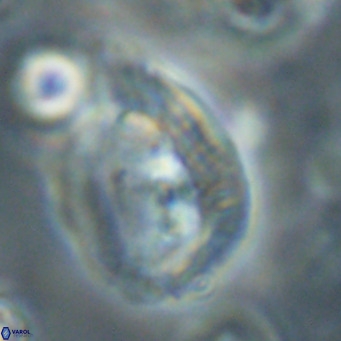 Helicosphaerella bipuncta VR 32979