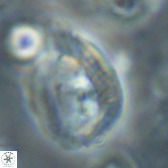Helicosphaerella bipuncta VR 32979