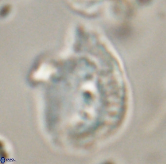 Helicosphaerella bipuncta VR 32970