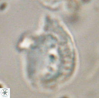 Helicosphaerella bipuncta VR 32970
