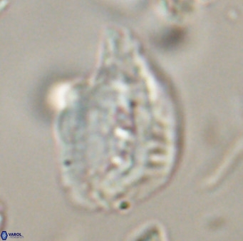 Helicosphaerella bipuncta VR 32971