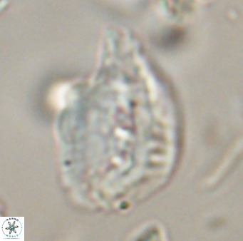 Helicosphaerella bipuncta VR 32971
