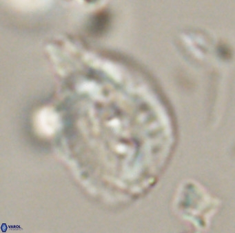 Helicosphaerella bipuncta VR 32972