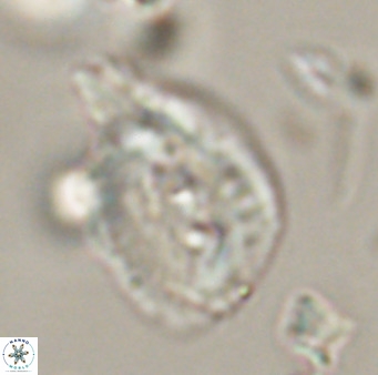 Helicosphaerella bipuncta VR 32972