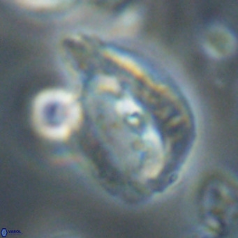 Helicosphaerella bipuncta VR 32973