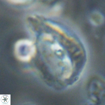 Helicosphaerella bipuncta VR 32973
