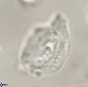 Helicosphaerella bipuncta VR 32984