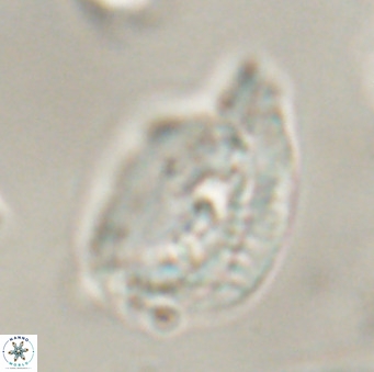 Helicosphaerella bipuncta VR 32984