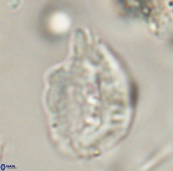 Helicosphaerella bipuncta VR 32985