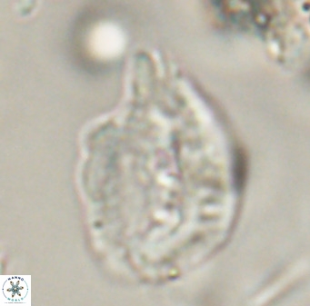 Helicosphaerella bipuncta VR 32985