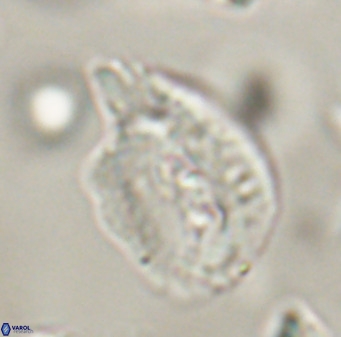 Helicosphaerella bipuncta VR 32986