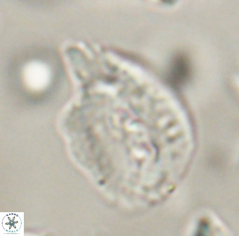 Helicosphaerella bipuncta VR 32986