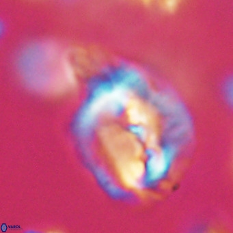 Helicosphaerella bipuncta VR 32987