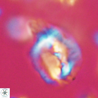 Helicosphaerella bipuncta VR 32987