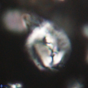Helicosphaerella bipuncta VR 32988