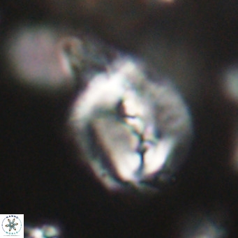 Helicosphaerella bipuncta VR 32988