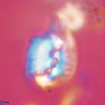 Helicosphaerella bipuncta VR 32989