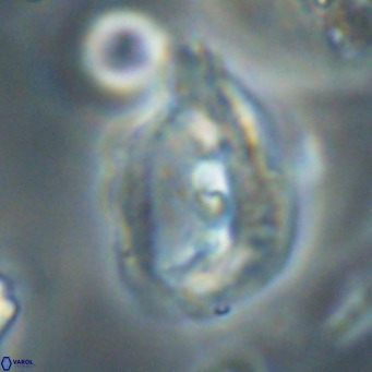 Helicosphaerella bipuncta VR 32980