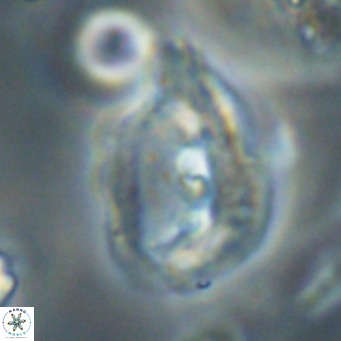 Helicosphaerella bipuncta VR 32980