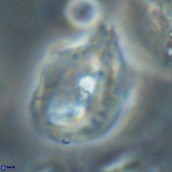 Helicosphaerella bipuncta VR 32981