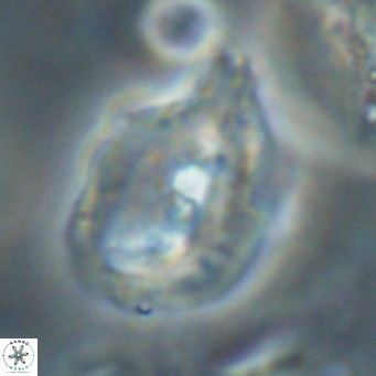 Helicosphaerella bipuncta VR 32981
