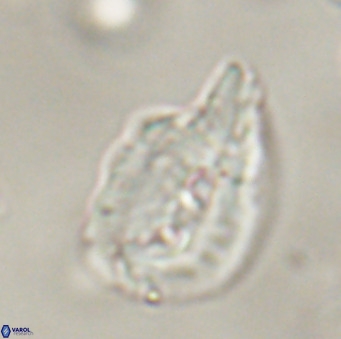 Helicosphaerella bipuncta VR 32982