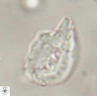 Helicosphaerella bipuncta VR 32982