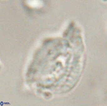 Helicosphaerella bipuncta VR 32983