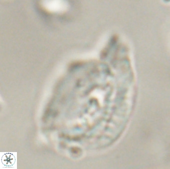 Helicosphaerella bipuncta VR 32983