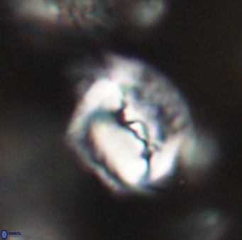Helicosphaerella bipuncta VR 32994