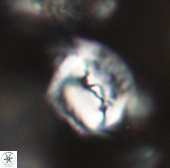 Helicosphaerella bipuncta VR 32994