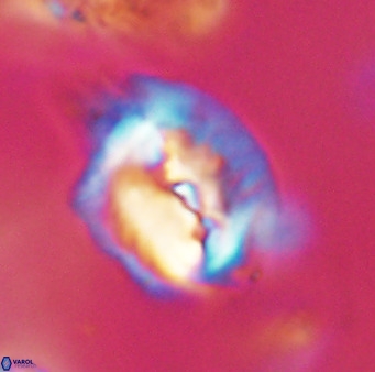 Helicosphaerella bipuncta VR 32995