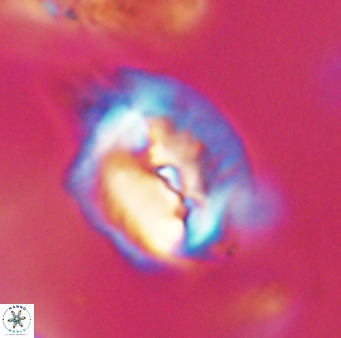 Helicosphaerella bipuncta VR 32995