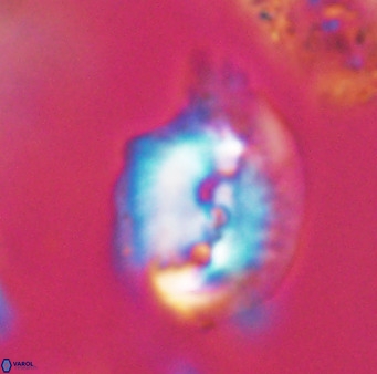 Helicosphaerella bipuncta VR 32996