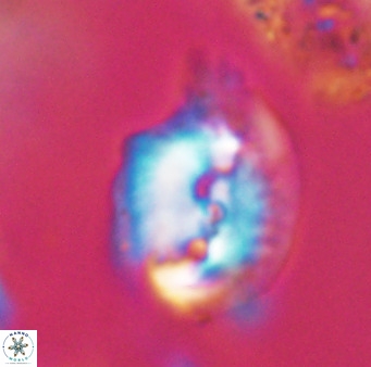 Helicosphaerella bipuncta VR 32996