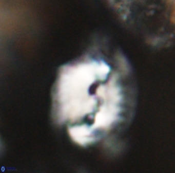 Helicosphaerella bipuncta VR 32997
