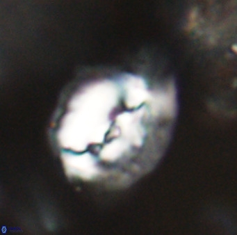 Helicosphaerella bipuncta VR 32998